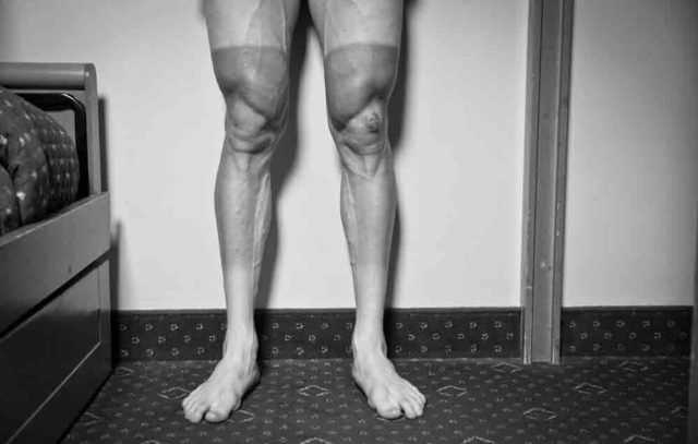 quads-main-gettyimages-494333913-1