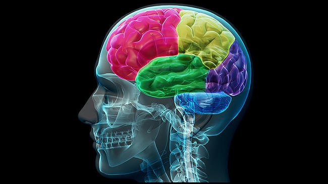 brain-809
