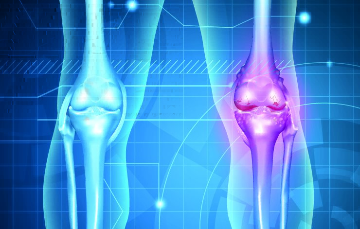 knee-pain-1